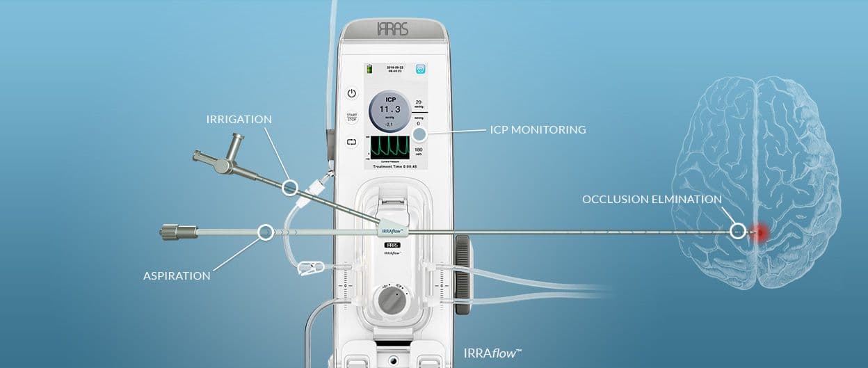 IRRAS lanserar IRRAflowTM v 2.5 med flera uppgraderingar, bland annat uppdaterad batterikonfiguration