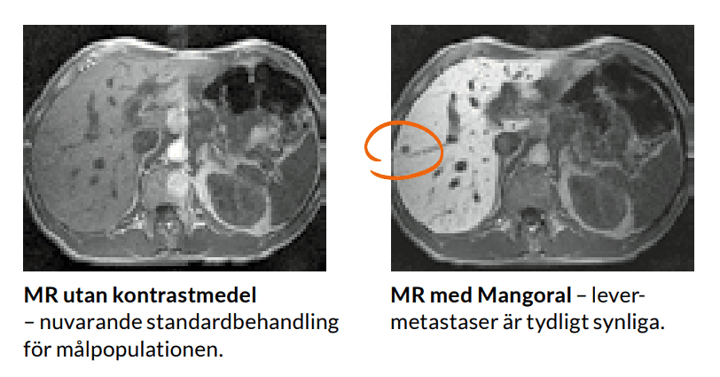 IPO: ASCELIA UPPTÄCKER OCH BEHANDLAR CANCER BÄTTRE - VD