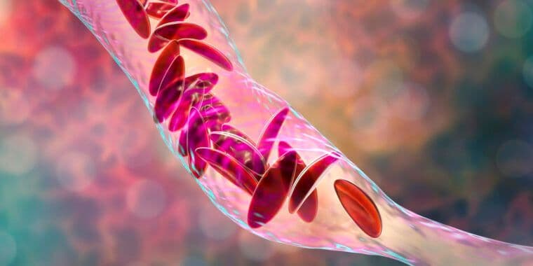 IPO Modus Therapeutics