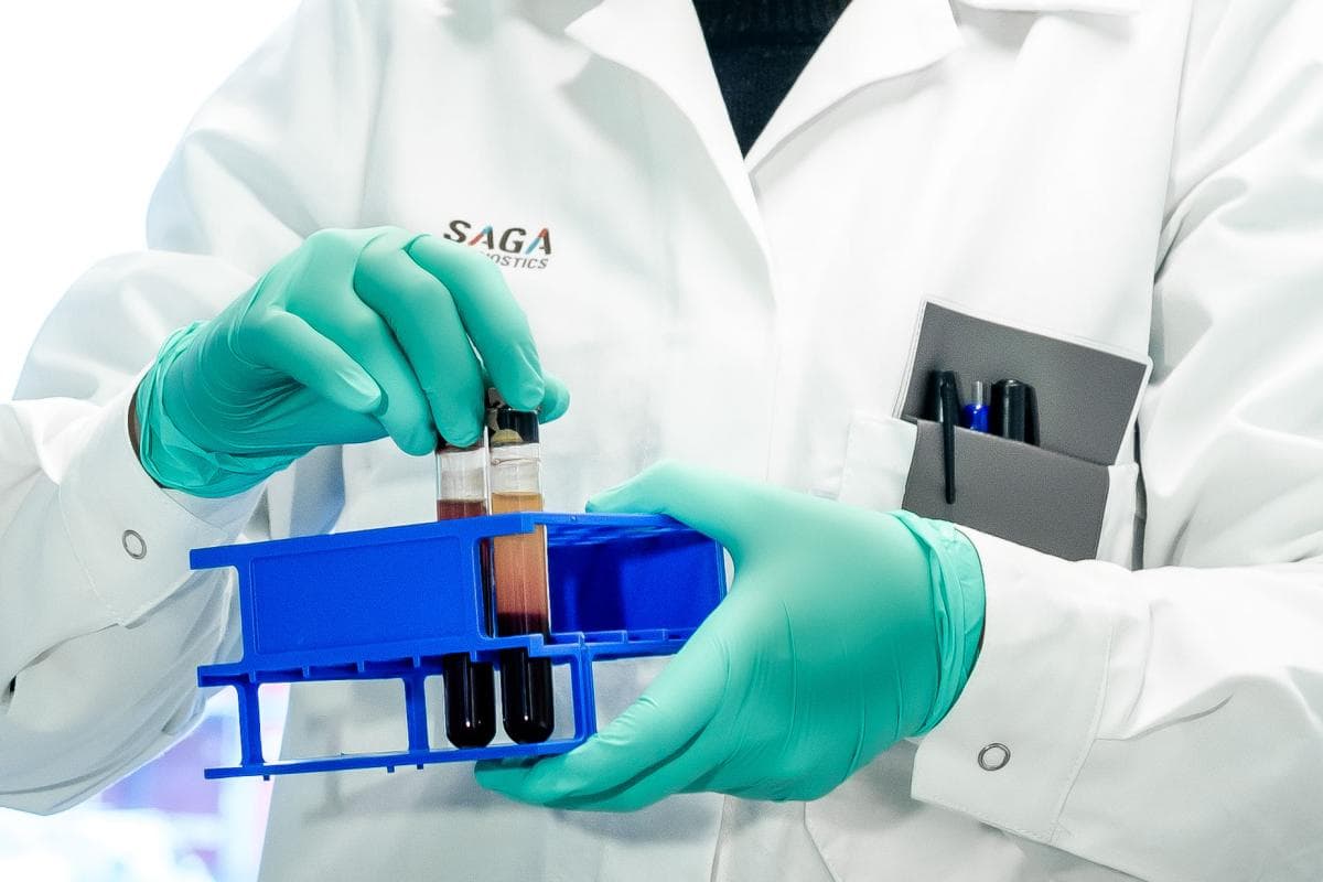 Sciety-nätverket och Segulah Medical Acceleration investerar 106 MSEK i SAGA Diagnostics
